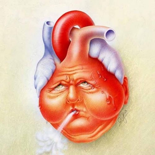 Tìm hiểu hội chứng suy tim và hậu quả của suy tim