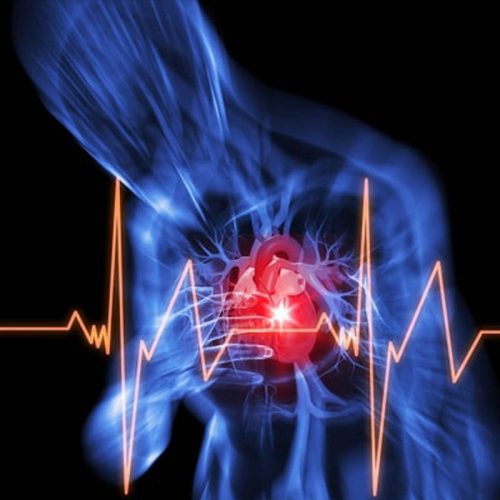 Suy tim mất bù, suy tim còn bù: Triệu chứng, nguyên nhân, điều trị