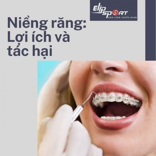 Niềng răng là gì? Các tác dụng của niềng răng có thể bạn chưa biết