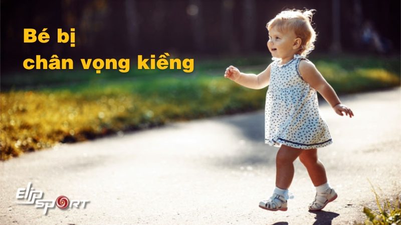 Làm thế nào khi bé bị chân vòng kiềng? 9 cách khắc phục